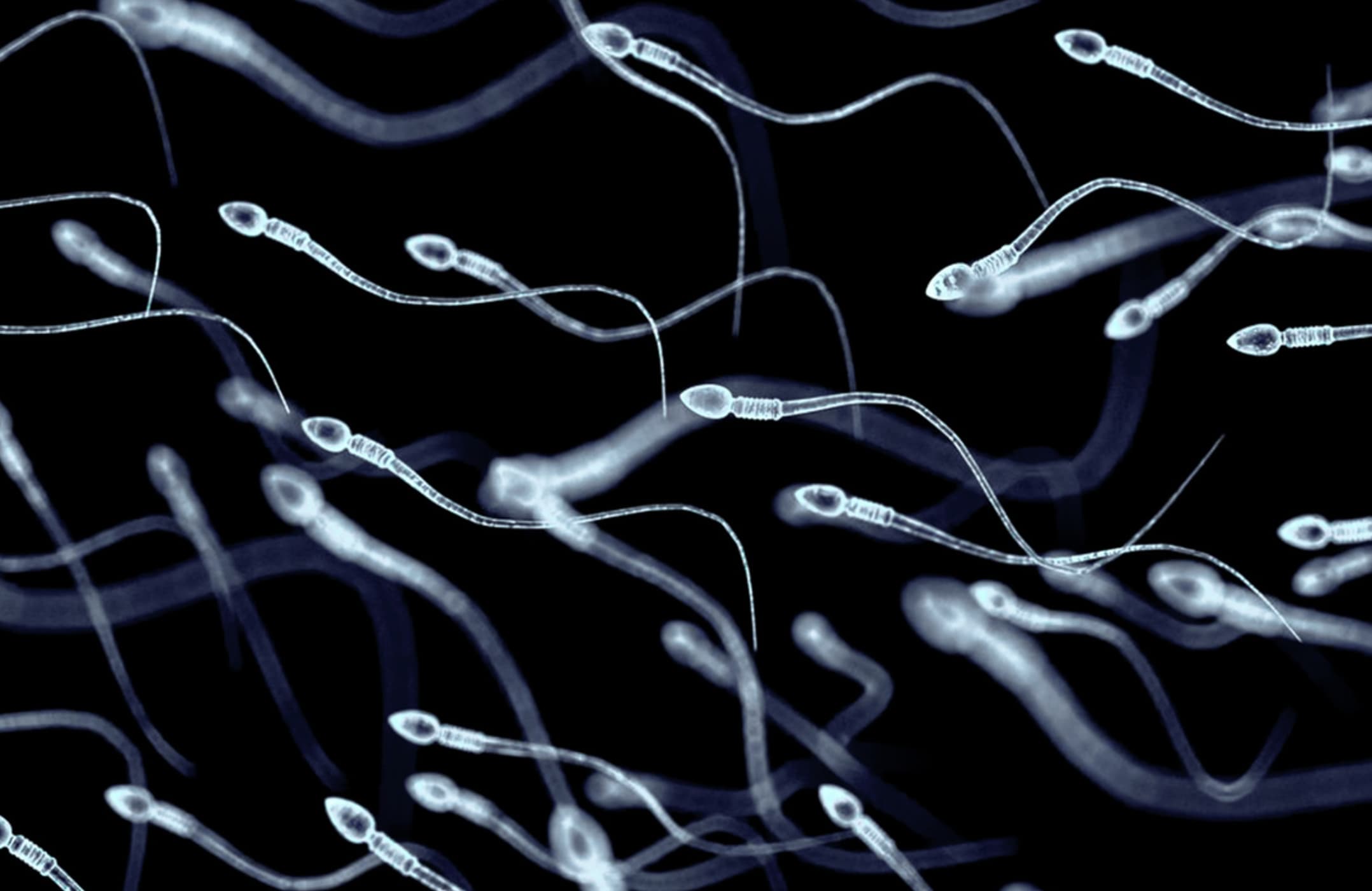 sperm problem in men - Mund Om